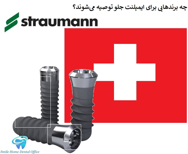 چه برندهایی برای ایمپلنت جلو توصیه می‌شوند؟