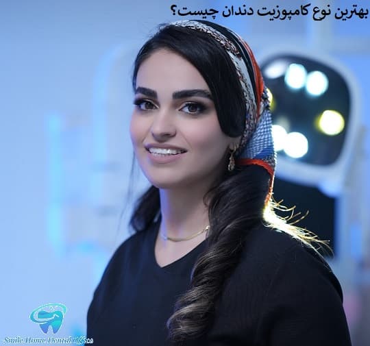 بهترین نوع کامپوزیت دندان چیست؟