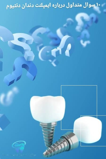۱۰ سوال متداول درباره ایمپلنت دندان دنتیوم
