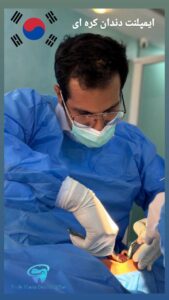 ایمپلنت دندان کره‌ای