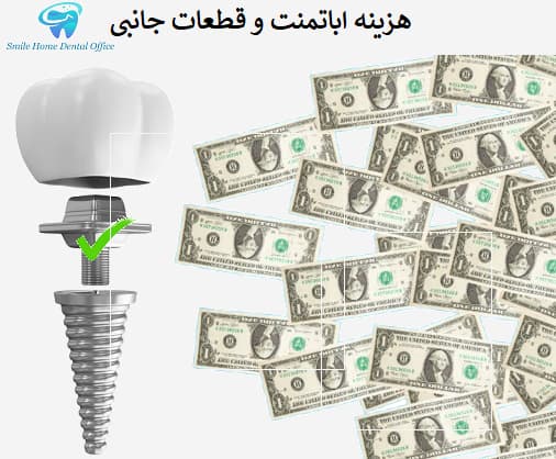 هزینه اباتمنت و قطعات جانبی
