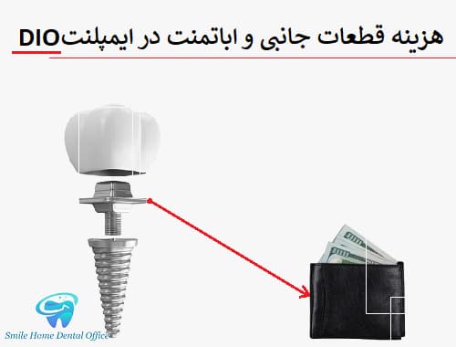 هزینه قطعات جانبی و اباتمنت در ایمپلنت DIO