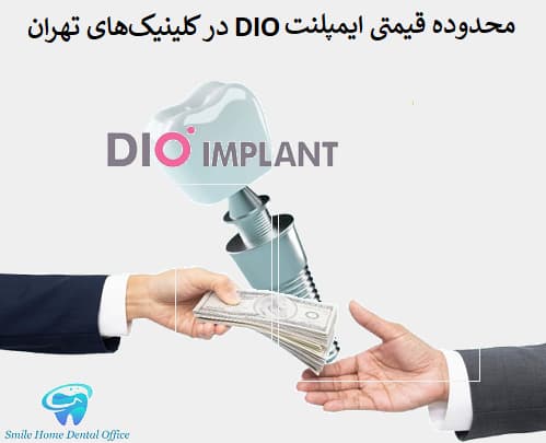 محدوده قیمتی ایمپلنت DIO در کلینیکهای تهران