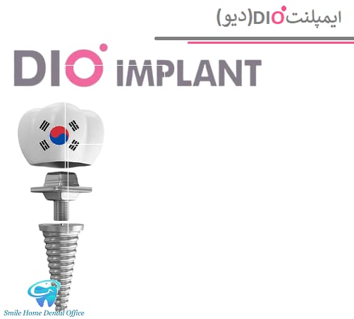 ایمپلنت DIO(دیو)