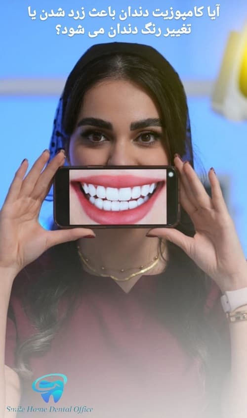 آیا کامپوزیت دندان باعث زرد شدن یا تغییر رنگ می شود؟