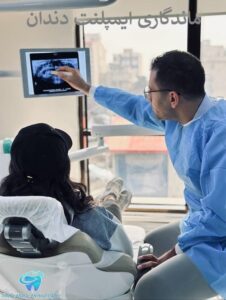 ماندگاری ایمپلنت دندان