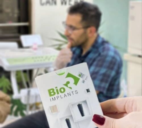 عوامل پس‌زدن ایمپلنت دندان و راه‌های پیشگیری