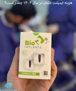 ایمپلنت دندان در سال ۱۴۰۴ چقدر است؟