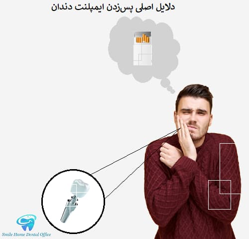 دلایل اصلی پس‌زدن ایمپلنت دندان