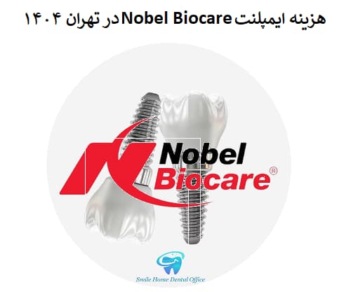 هزینه ایمپلنت Nobel Biocare در تهران ۱۴۰۴