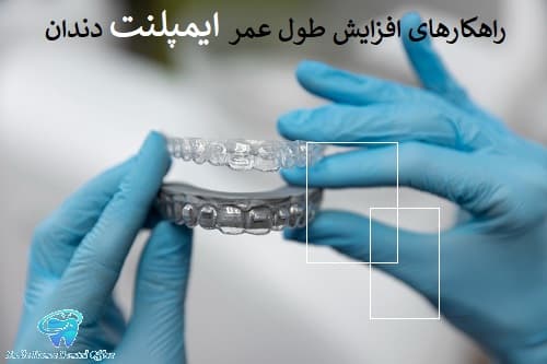راهکارهای افزایش طول عمر ایمپلنت دندان