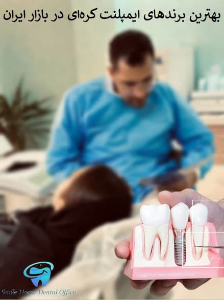 بهترین برندهای ایمپلنت کره‌ای در بازار ایران