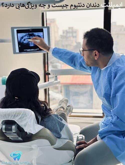 ایمپلنت دندان دنتیوم چیست و چه ویژگی‌هایی دارد؟