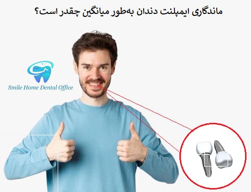ماندگاری ایمپلنت دندان بهطور میانگین چقدر است؟