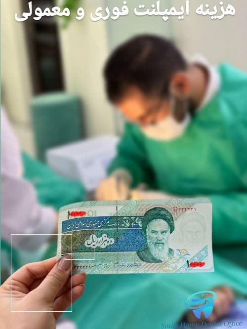 هزینه ایمپلنت فوری و معمولی