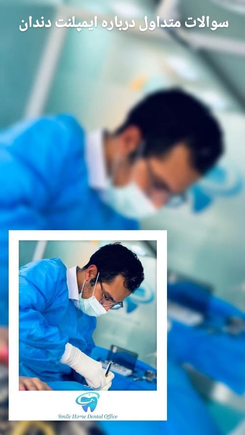 سوالات متداول درباره ایمپلنت دندان