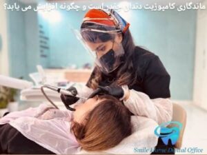 ماندگاری کامپوزیت دندان چقدر است و چگونه افزایش می‌یابد؟