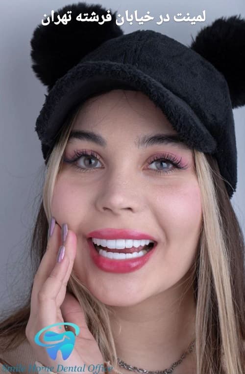 لمینت در خیابان فرشته تهران