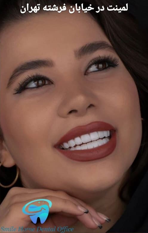 لمینت در خیابان فرشته تهران