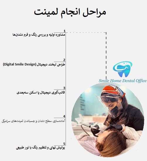 مراحل انجام لمینت