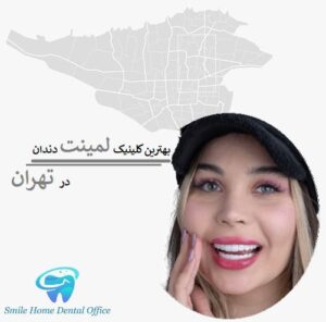 بهترین کلینیک لمینت دندان در تهران