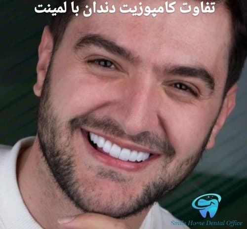 تفاوت کامپوزیت دندان با لمینت