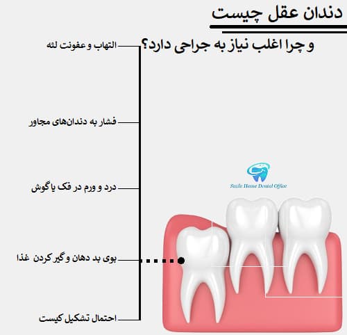 دندان عقل چیست و چرا اغلب نیاز به جراحی دارد؟