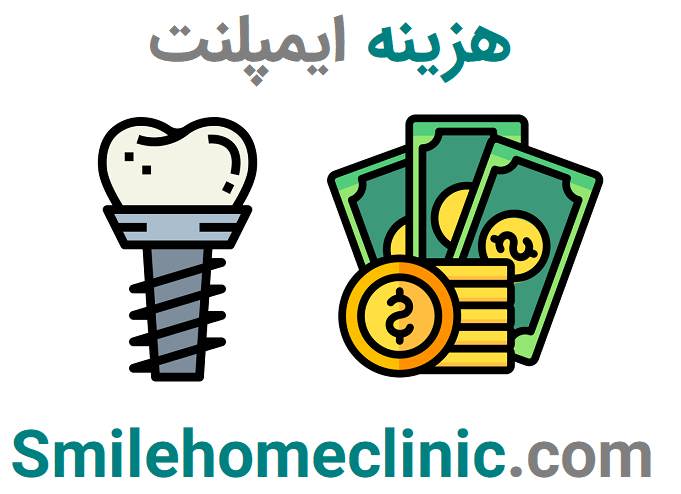 هزینه ایمپلنت در شمال تهران ۱۴۰۴