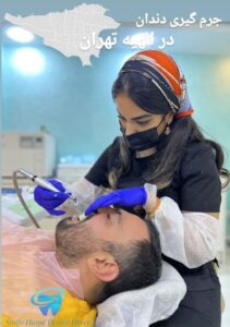جرم گیری دندان در الهیه تهران