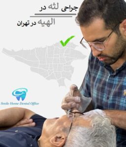 جراحی لثه در الهیه در تهران