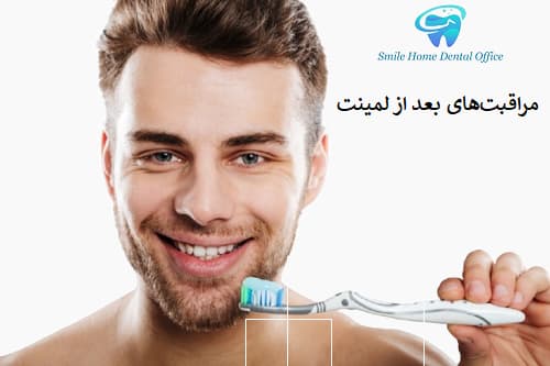 مراقبت‌های بعد از لمینت و روش حفظ ماندگاری