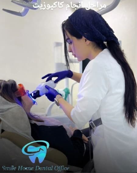 مراحل انجام بلیچینگ دندان در کلینیک