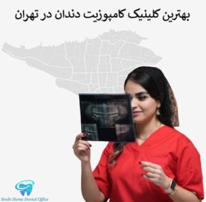 بهترین کلینیک کامپوزیت دندان در تهران