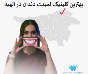بهترین کلینیک لمینت دندان در الهیه