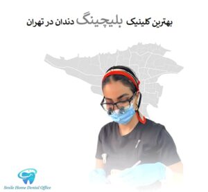 بهترین کلینیک بلیچینگ دندان در تهران