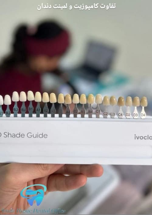 تفاوت کامپوزیت و لمینت