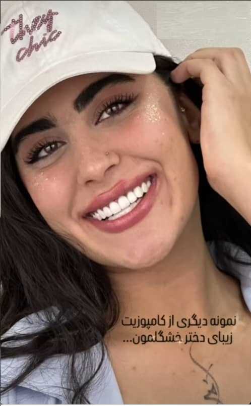 لمینت شمال تهران