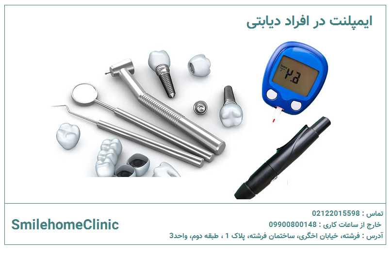 تفاوت برند ایمپلنت در بیماران دیابتی تا چه حد اهمیت دارد؟