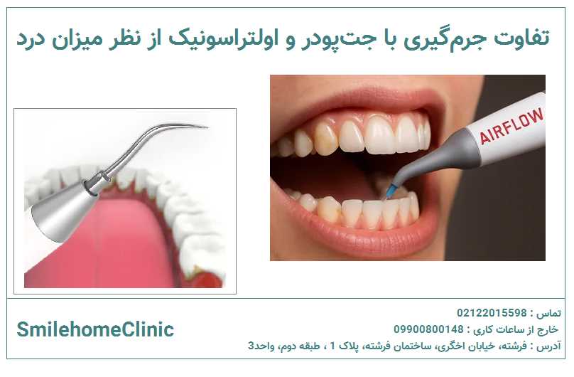 تفاوت جرم‌گیری با جت‌پودر و اولتراسونیک از نظر درد 
