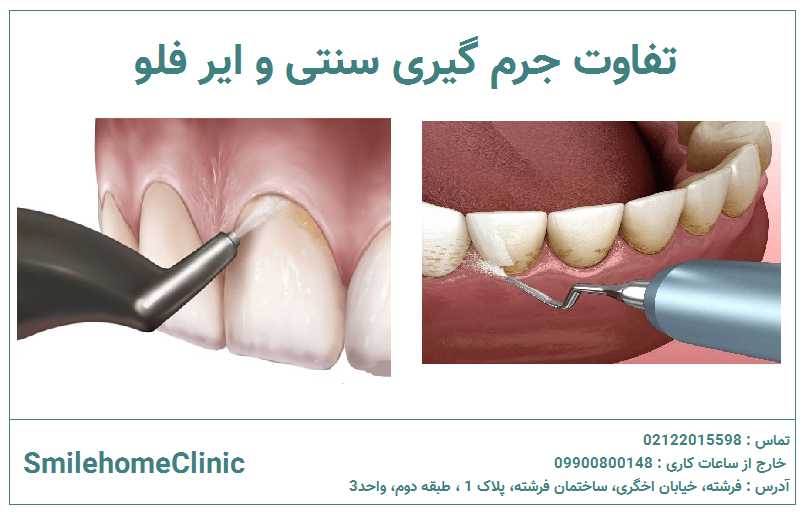 چه تفاوتی بین جرم‌گیری Air Flow و جرم‌گیری دستی وجود دارد؟
