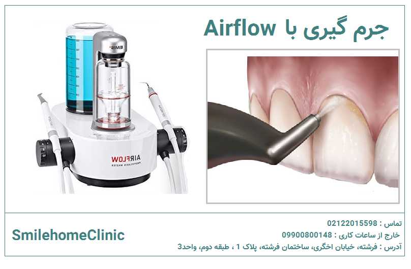 جرمگیری با airflow