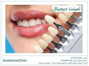 لمینت دیجیتال