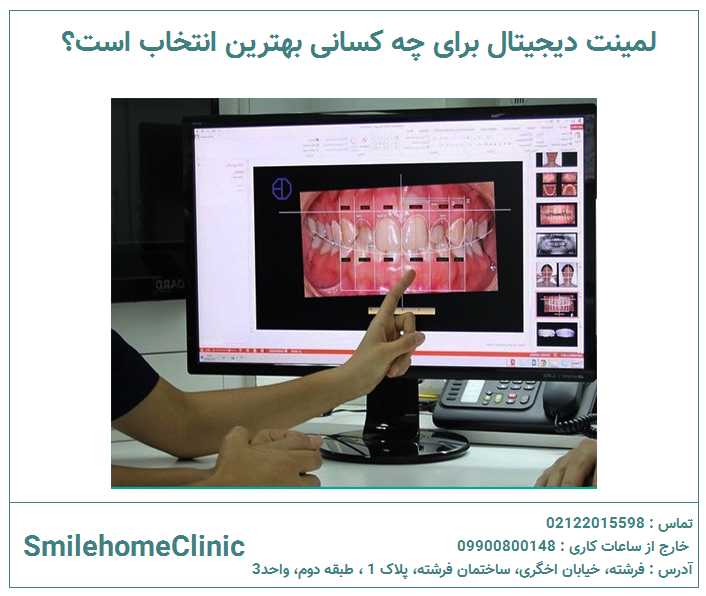 لمینت دیجیتال برای چه کسانی بهترین انتخاب است؟