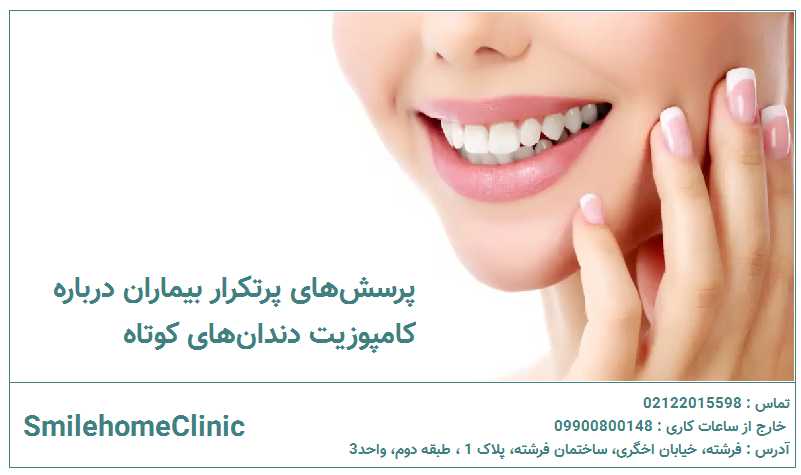 پرسش‌های پرتکرار بیماران درباره کامپوزیت دندان‌های کوتاه