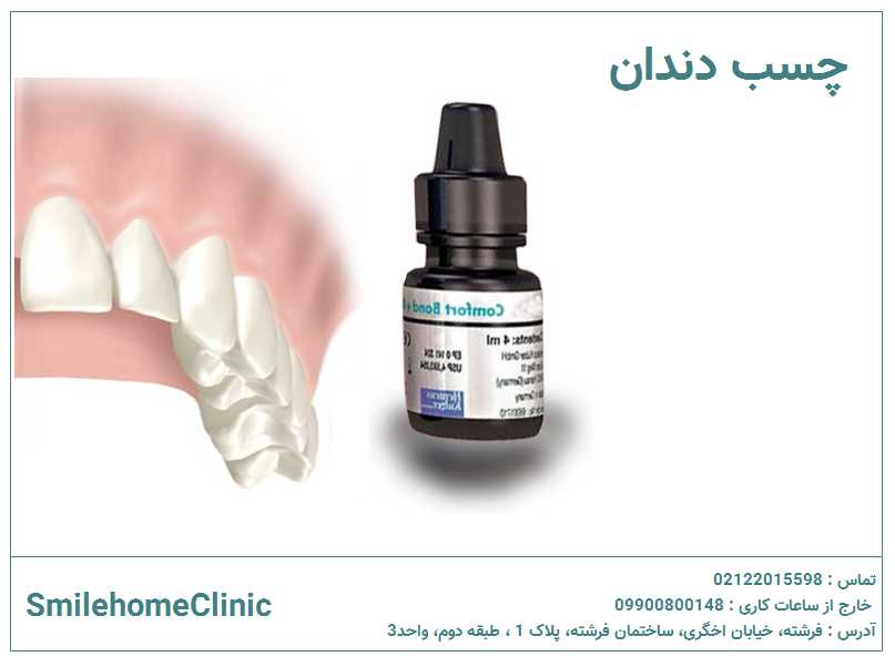 چسب دندان