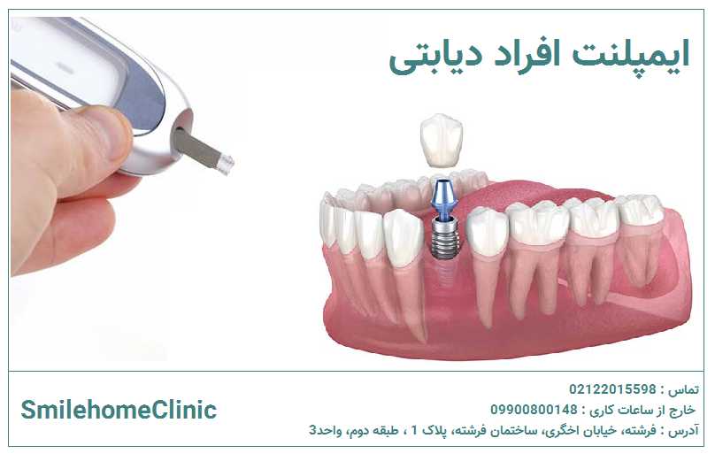 ایمپلنت برای افراد دیابتی
